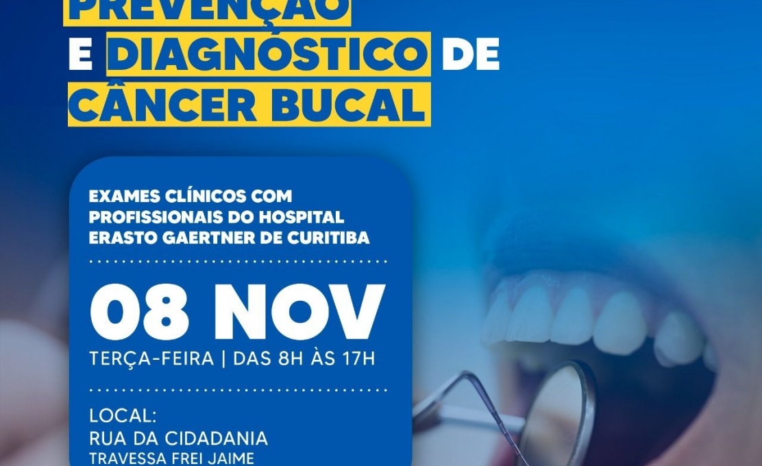Irati Realizará 5ª Campanha De Prevenção E Diagnóstico De Câncer Bucal